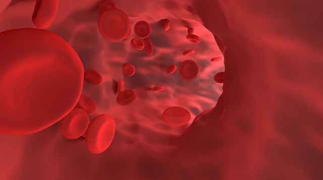 tromboza - krvne zrazeniny